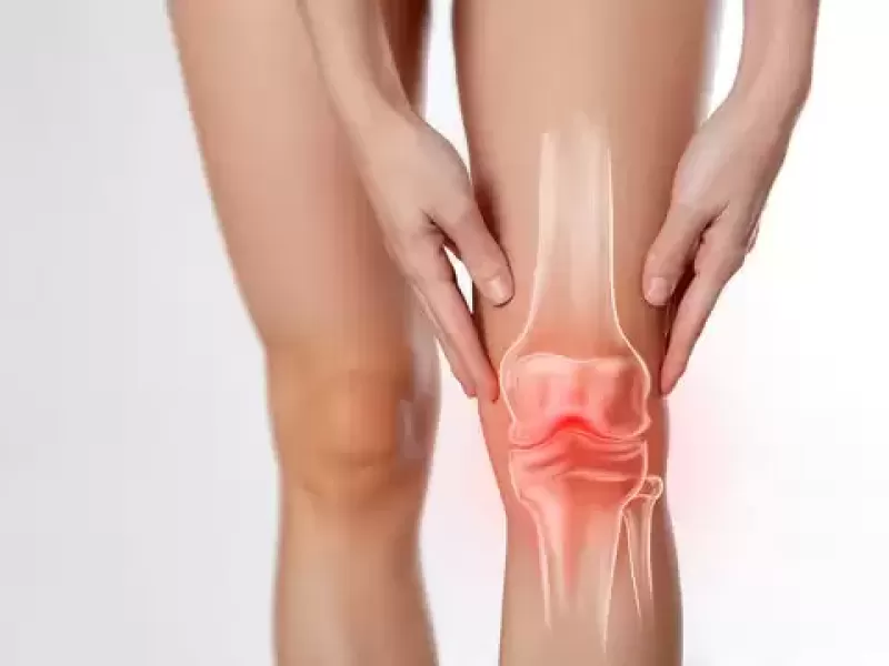 Prognóstico em longo prazo para Artroplastia
